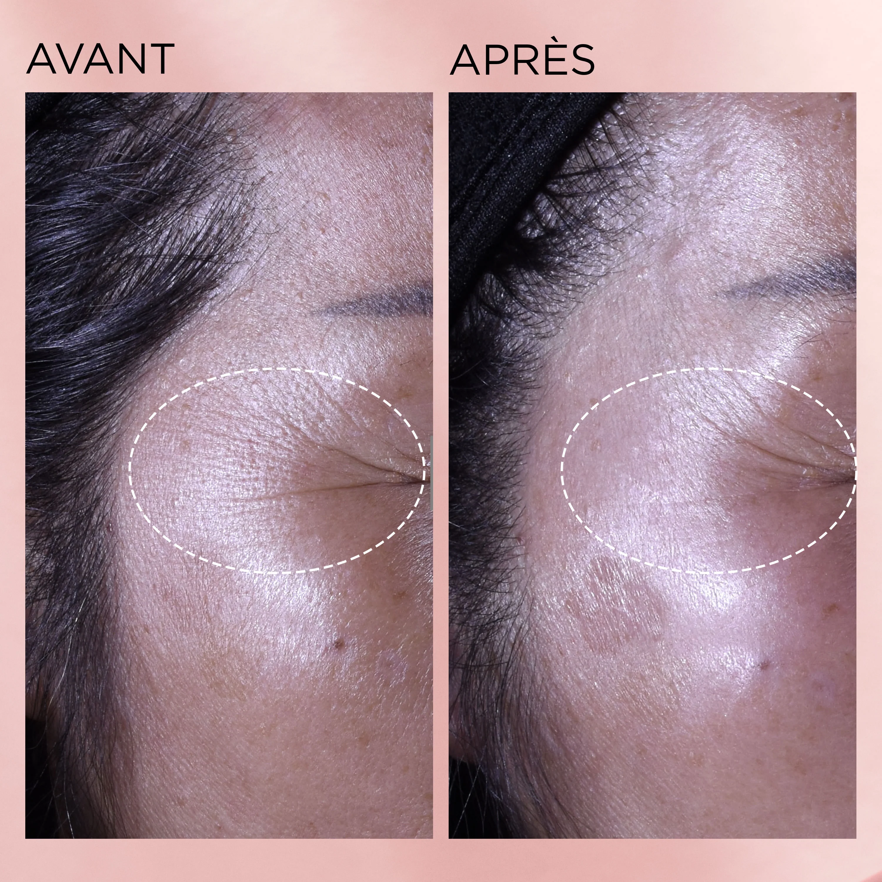 RETINOL + HPR Ceramide Capsules Sérum Régénération Accélérée - Image 8