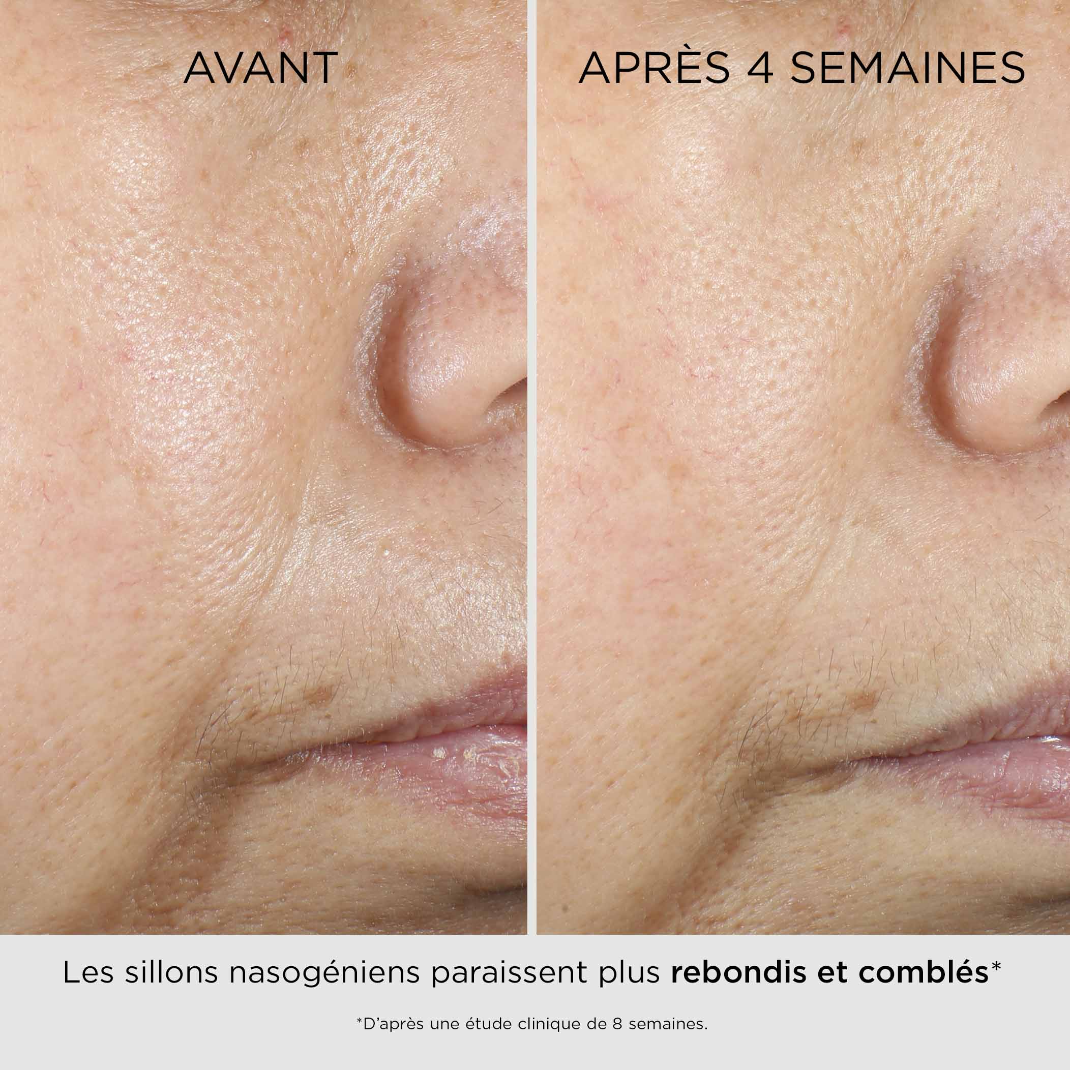 PREVAGE® crème légère multi-régénérante - Image 11