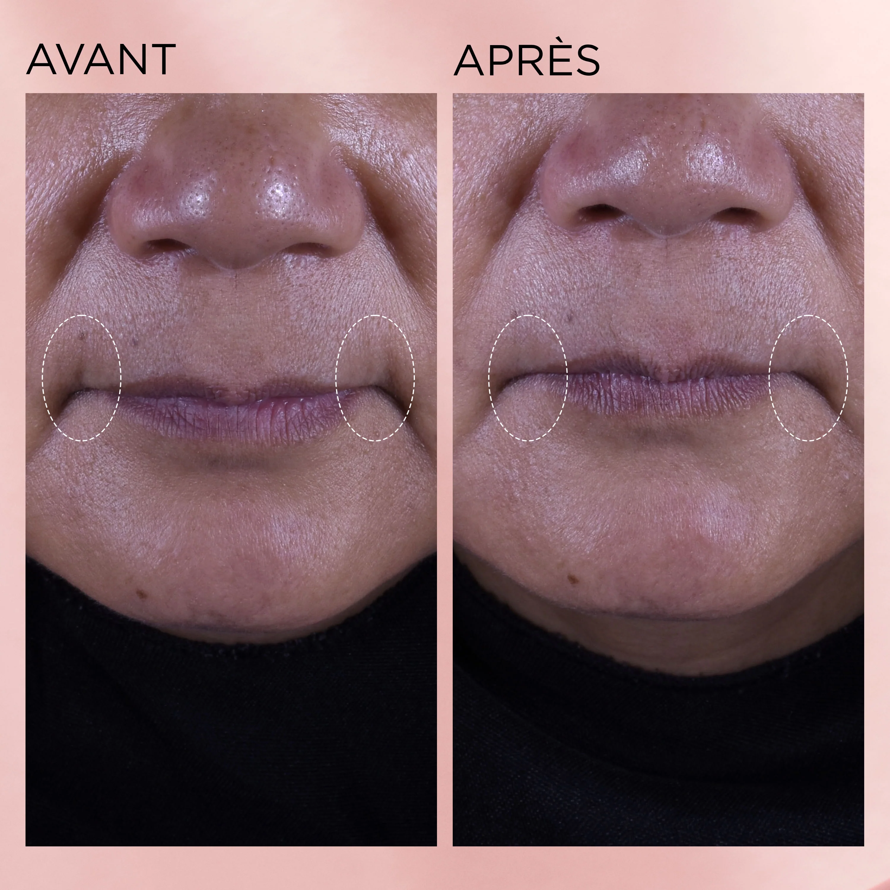 Rétinol + HPR Ceramide Aqua-Crème Régénérante - Image 8