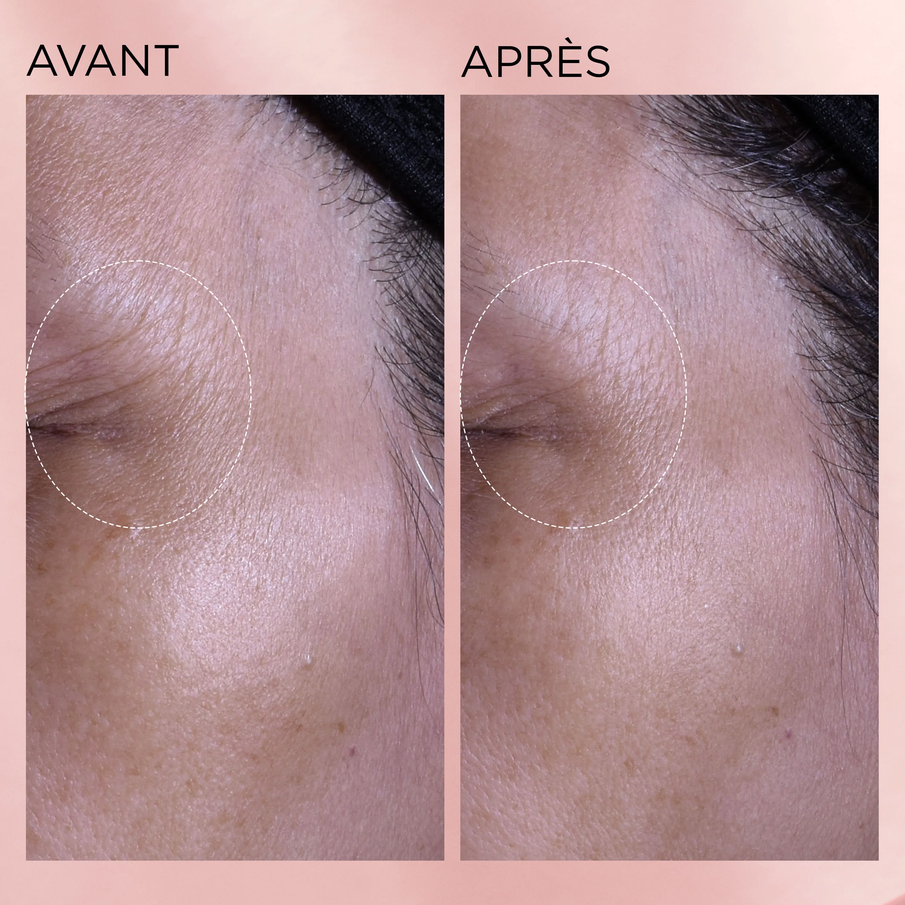 Rétinol + HPR Ceramide Aqua-Crème Régénérante - Image 9
