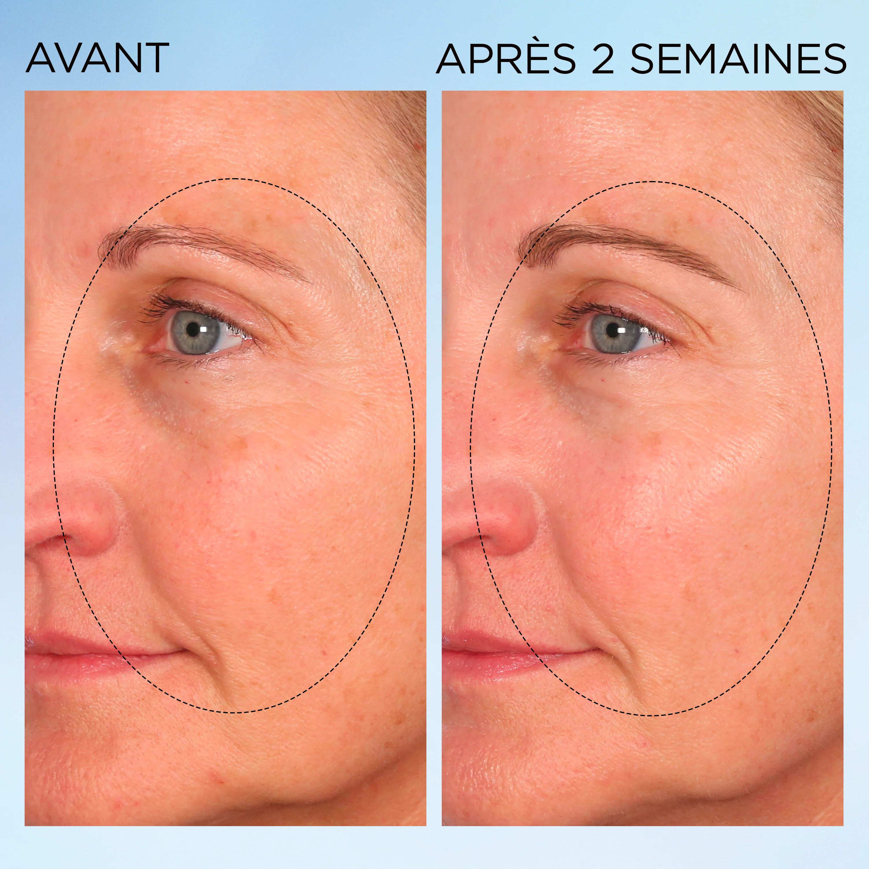 Visible Brightening Capsules Sérum Correctrices Anti-taches Booster d’Éclat - Image 10