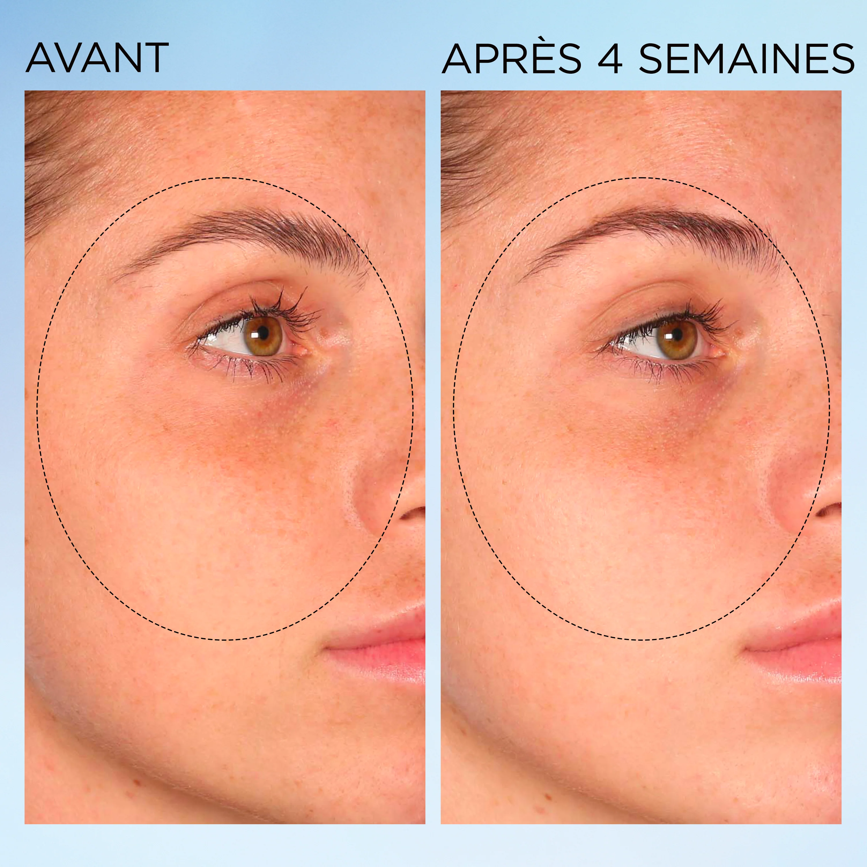 Visible Brightening Capsules Sérum Correctrices Anti-taches Booster d’Éclat - Image 12
