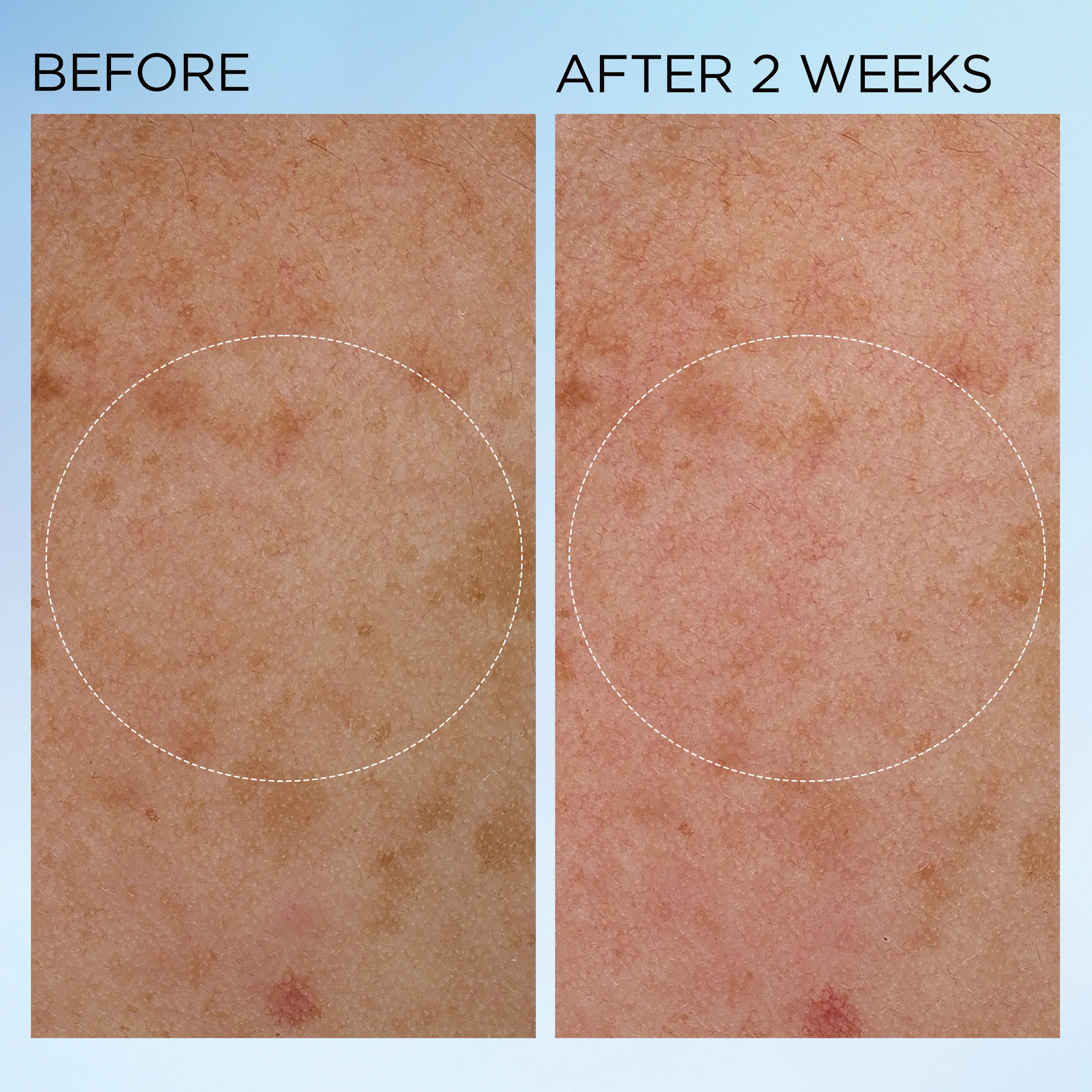 Visible Brightening Gel-crème Booster d’Éclat - Image 9